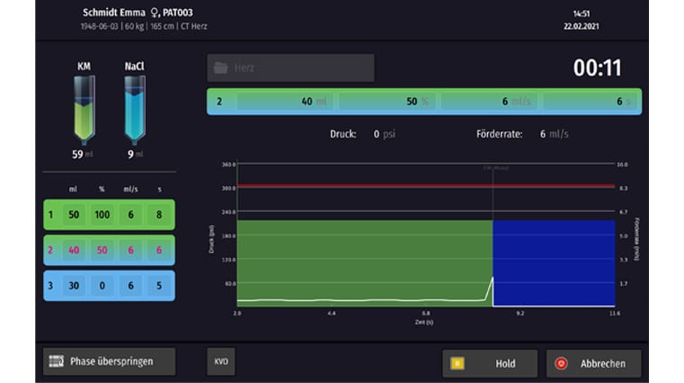 Accutron CT-D Vision ueberarbeitete Benutzeroberflaeche des Injektors und auch der Fernbedienung